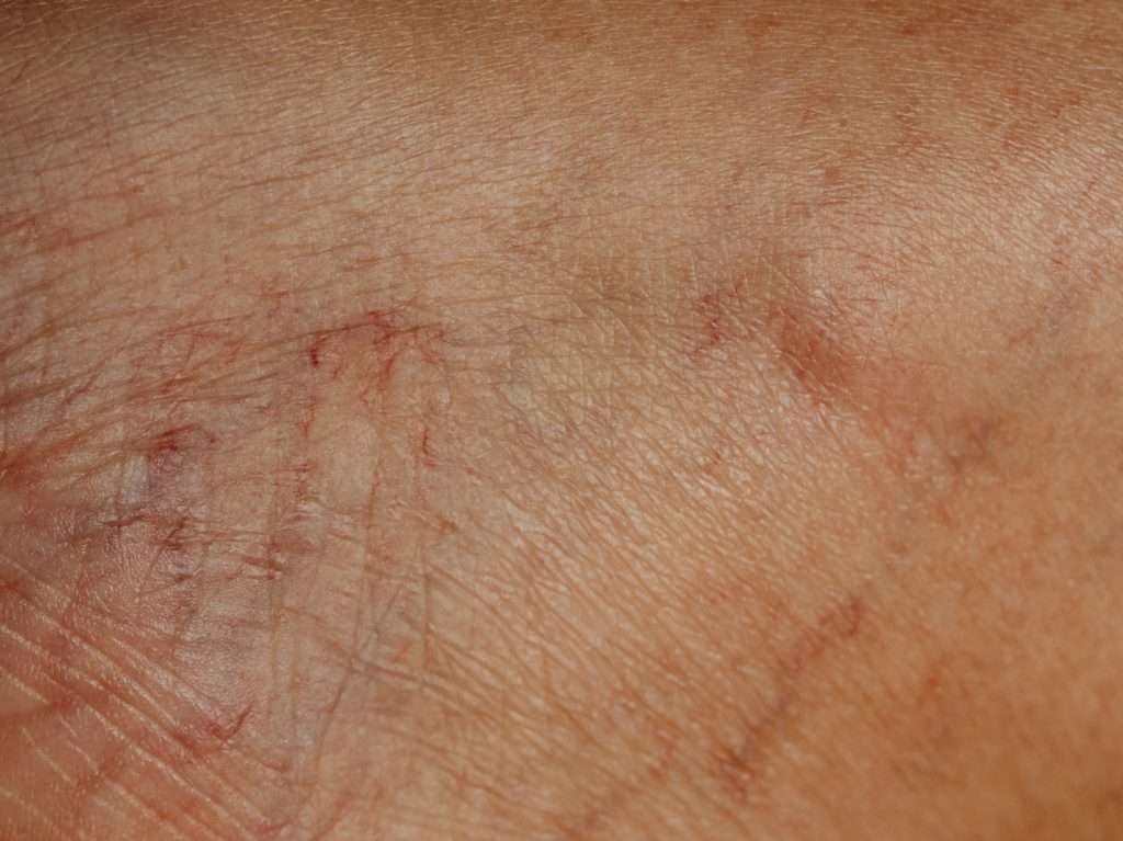 Close-up of Human Skin